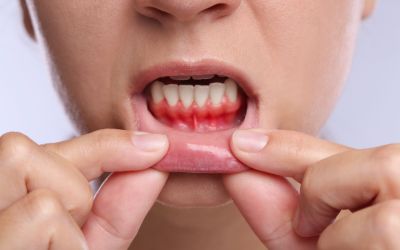 11月9日は、歯ぐきの日です。